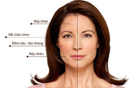 Tầm quan trọng của collagen với da