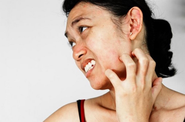 Cách trị da mặt bị ngứa và sần sùi an toàn, hiệu quả nhất