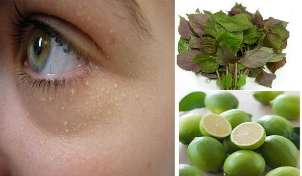 Cách sử dụng các loại thảo dược để trị mụn thịt quanh mắt như thế nào?
