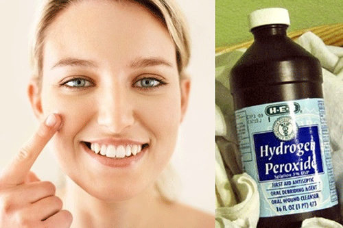 Hydrogen peroxide trị mụn đầu đen - tri mun bang hydrogen peroxide