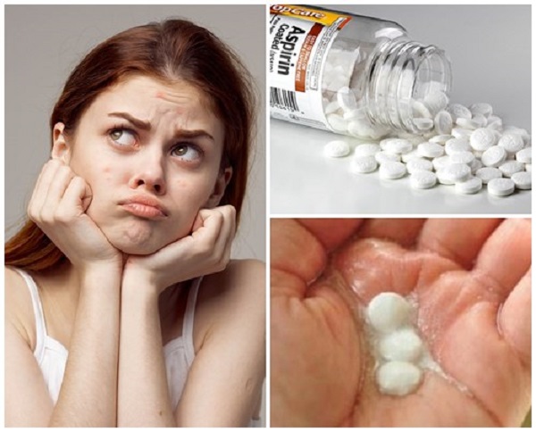 Kem trị mụn bằng thuốc Aspirin