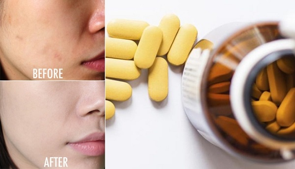 Dùng vitamin B1 làm trắng da mặt có thực sự hiệu quả hay không? - vitamin b1 lam trang da mat